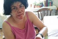Под Киевом тренер по тхэквондо избил женщину за требование не мусорить