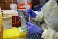 Лікар-інфекціоніст спрогнозував пік коронавірусу в Україні на кінець квітня