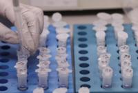 ИФА-тестирование во Львове: почти 12% имеют антитела к COVID-19