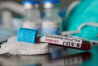 Кількість заражених коронавірусом в Білорусі стрімко зростає