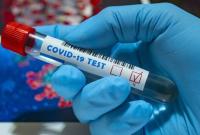 Украина получит тесты для определения коронавируса сразу на месте